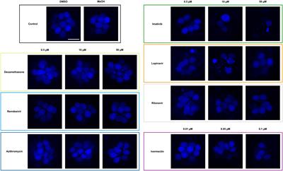 Putative COVID-19 therapies imatinib, lopinavir, ritonavir, and ivermectin cause hair cell damage: A targeted screen in the zebrafish lateral line